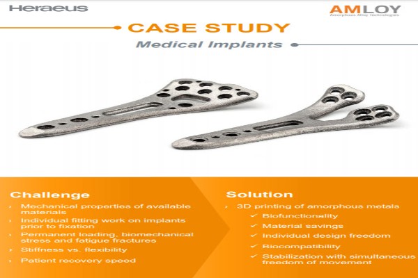 Case Study Medical Implants Amorphous Metals