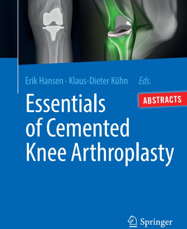Essentials of Cemented Knee Arthroplasty by Kuehn & Hansen (Eds.) - Table of Content