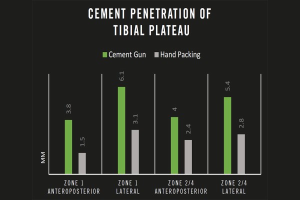 Figure 2: Cement Penetration of Tibial Plateau
